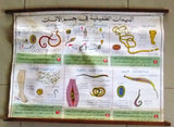 الديدان الطفيلية Parasitic worm Arabic Original French educational Poster 1974
