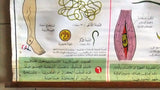 الديدان الطفيلية Parasitic worm Arabic Original French educational Poster 1974